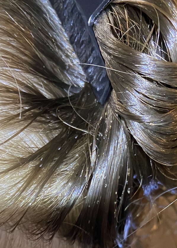 Indianapolis, IN Head lice treatment & inhome removal service